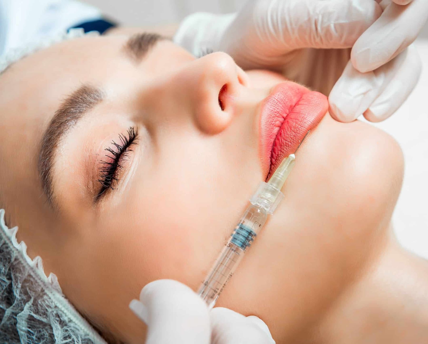 Dermal Fillers