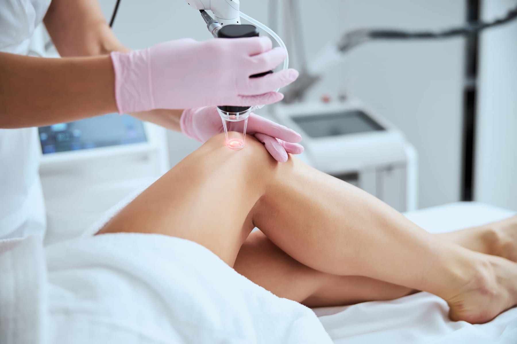 Varicose and Spider Vein Treatment