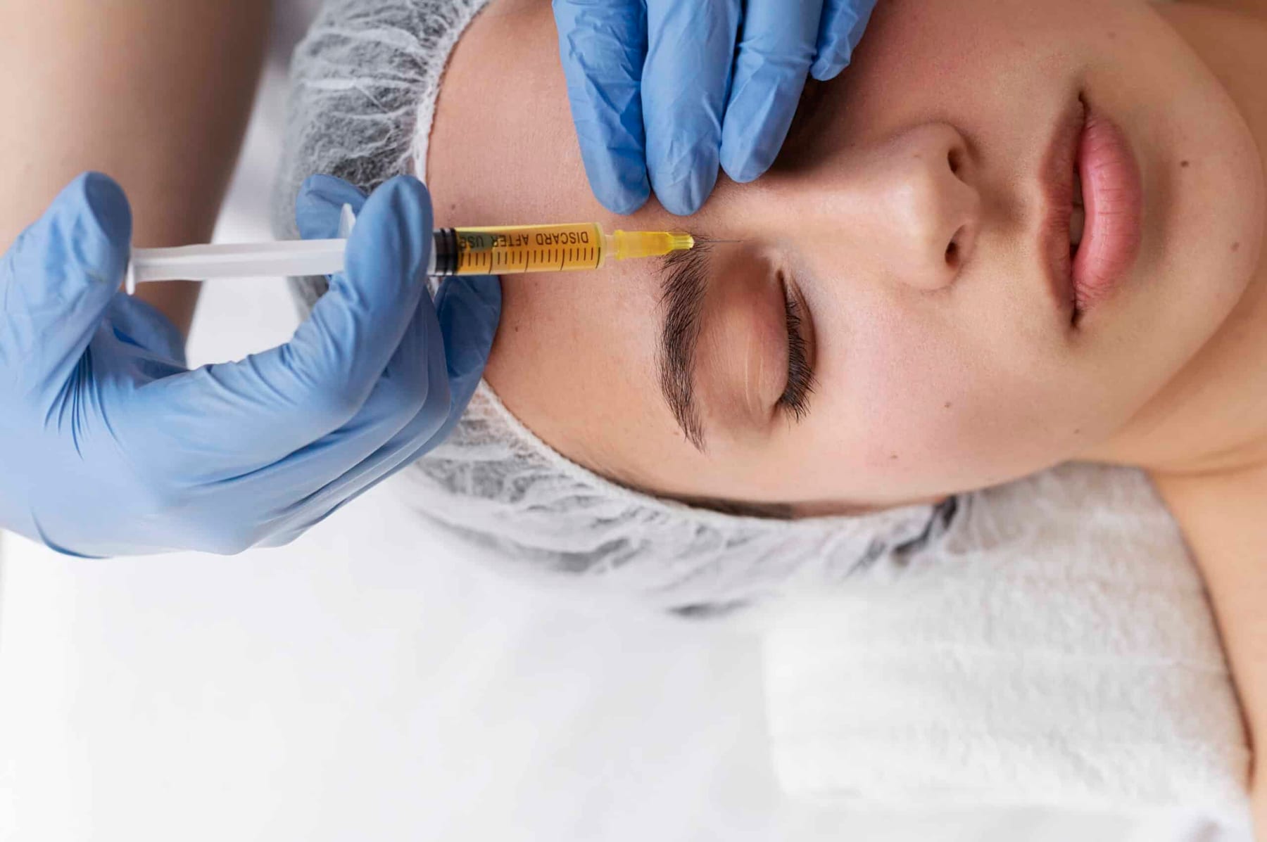 Dermal Fillers